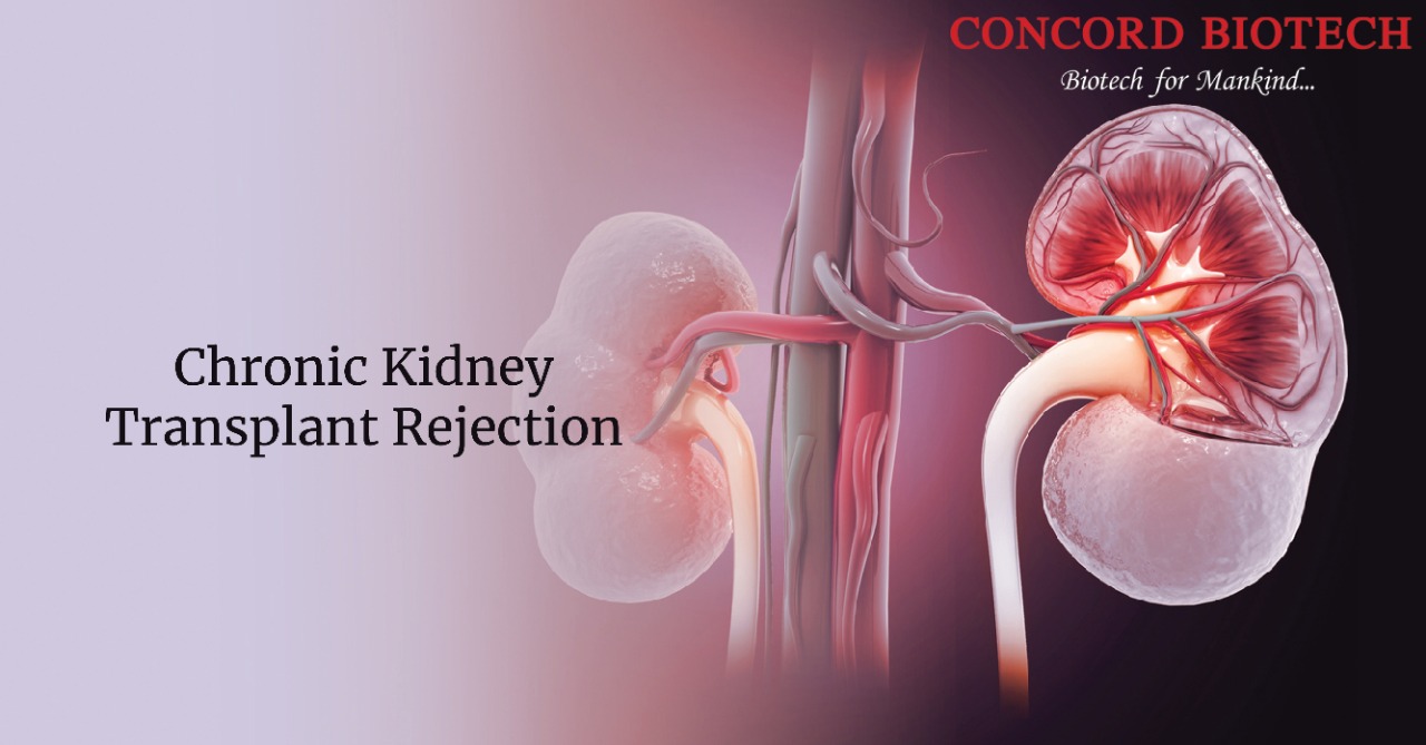 Prevents organ rejection after transplant